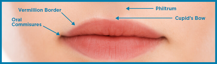 cupid's bow procedure