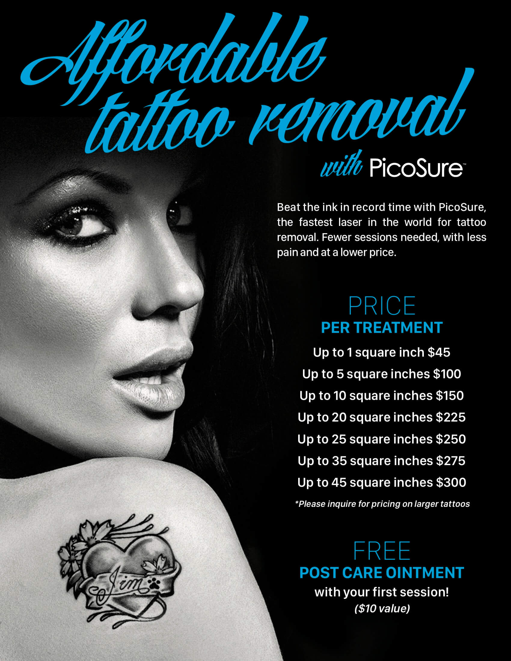 tattoo removal