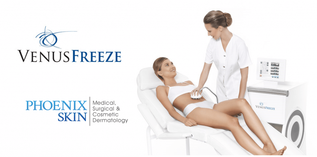 venus freeze phoenix scottsdale