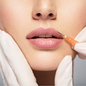 volumize dermal fillers