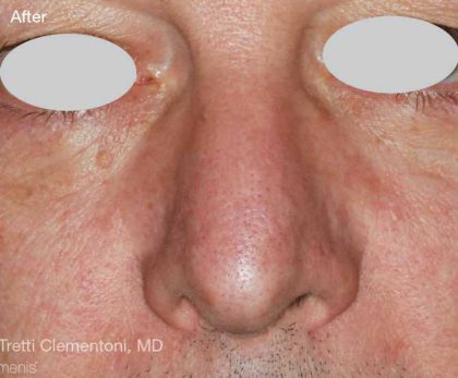 Before & After Patient #6196