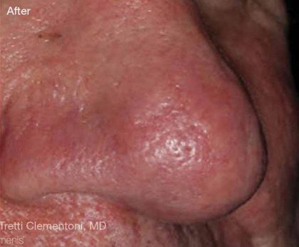 Before & After Patient #6193
