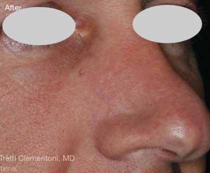 Before & After Patient #6195
