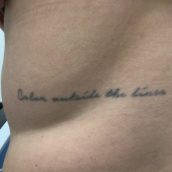 PicoSure Tattoo Removal Before & After Patient #8171